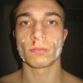 Shaving accident